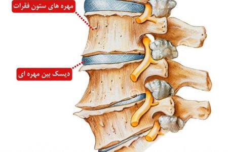 ساخت داربستی برای بافت لیفی دیسک بین مهره‌ای توسط محققان امیرکبیر